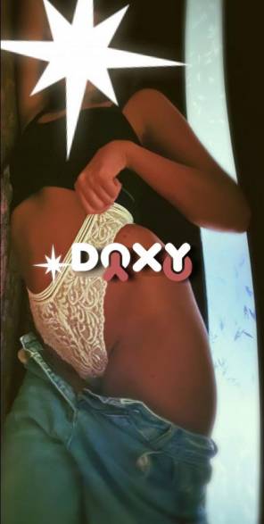 Фотография номер 7 - Мила, 24 года