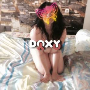 Фотография номер 4 - Роза, 25 лет